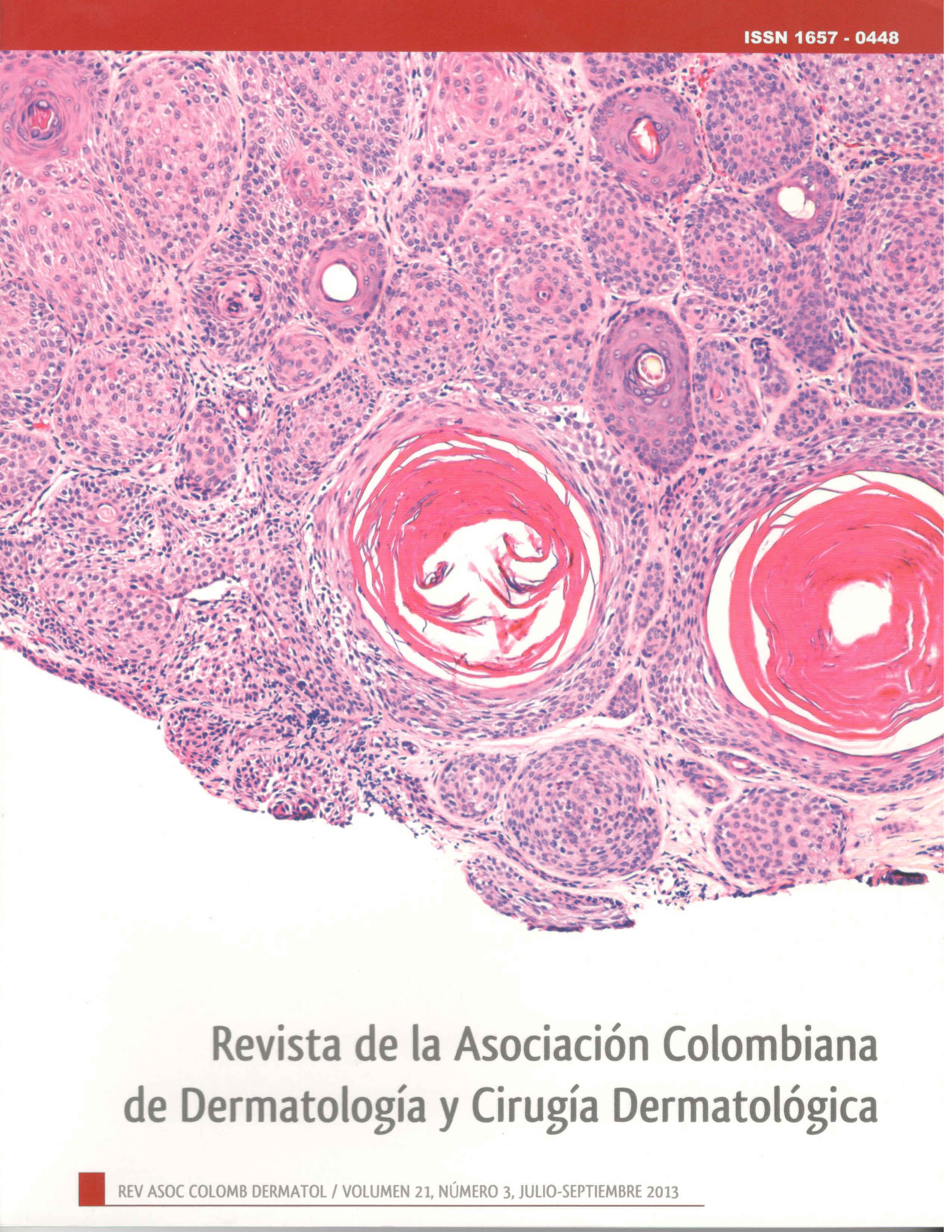 					Ver Vol. 21 Núm. 3 (2013): Julio – Septiembre
				