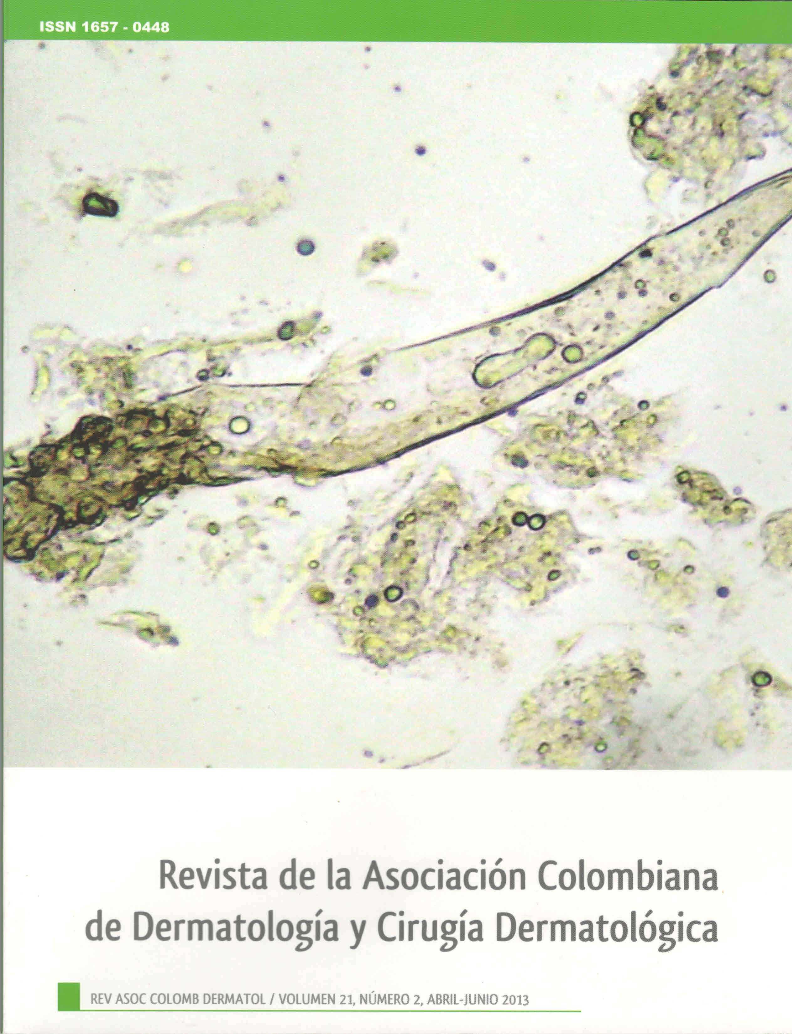 					Ver Vol. 21 Núm. 2 (2013): Abril - Junio
				