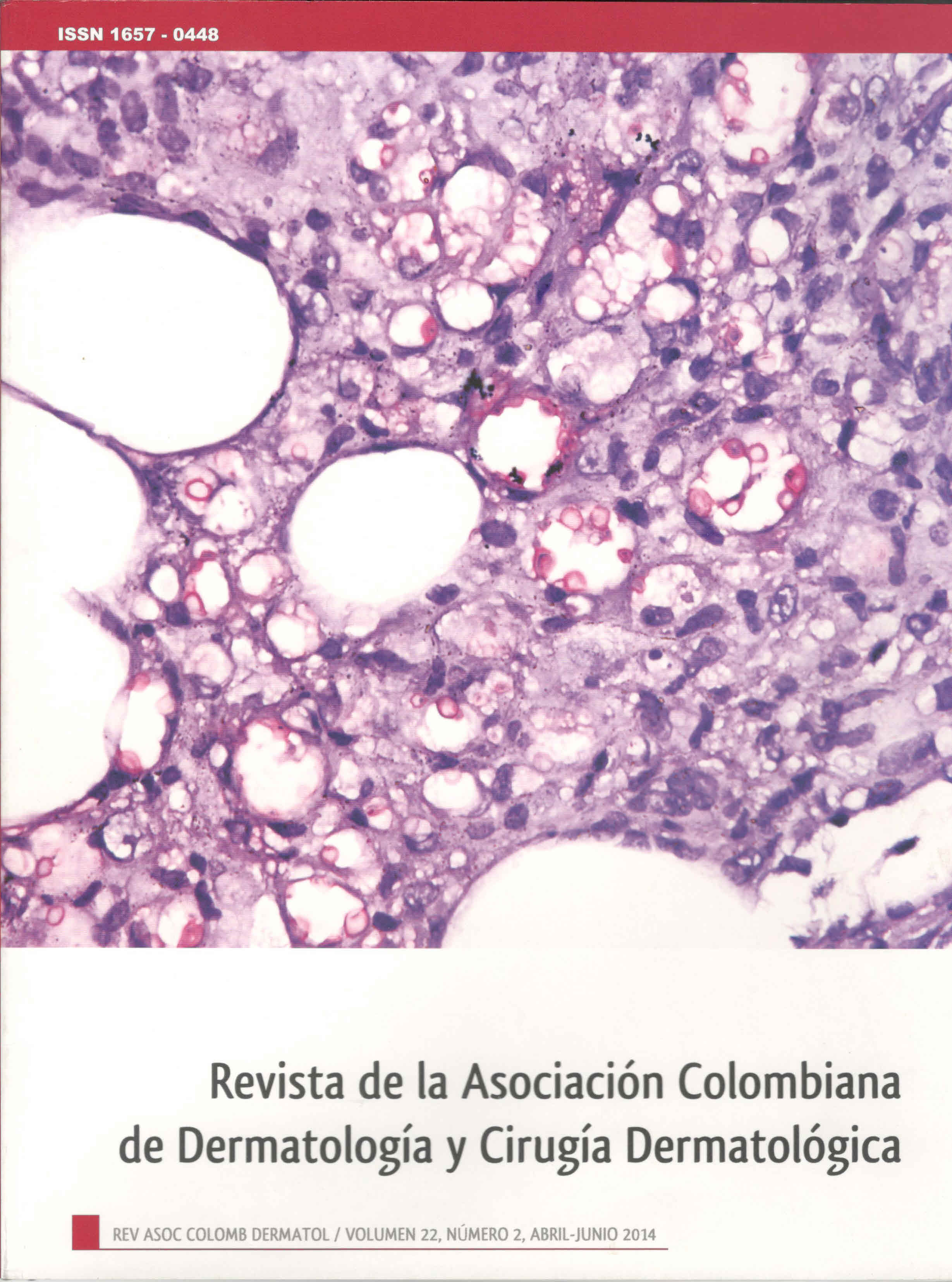 					Ver Vol. 22 Núm. 2 (2014): Abril - Junio
				