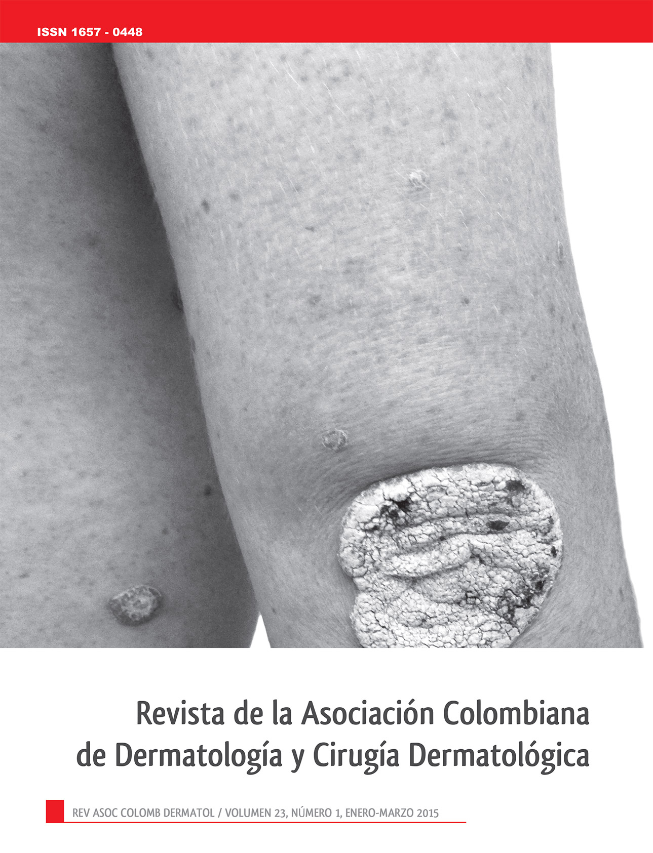 					Ver Vol. 23 Núm. 1 (2015): Enero - Marzo
				