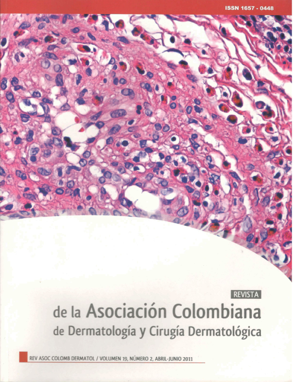 					Ver Vol. 19 Núm. 2 (2011): Abril - Junio
				