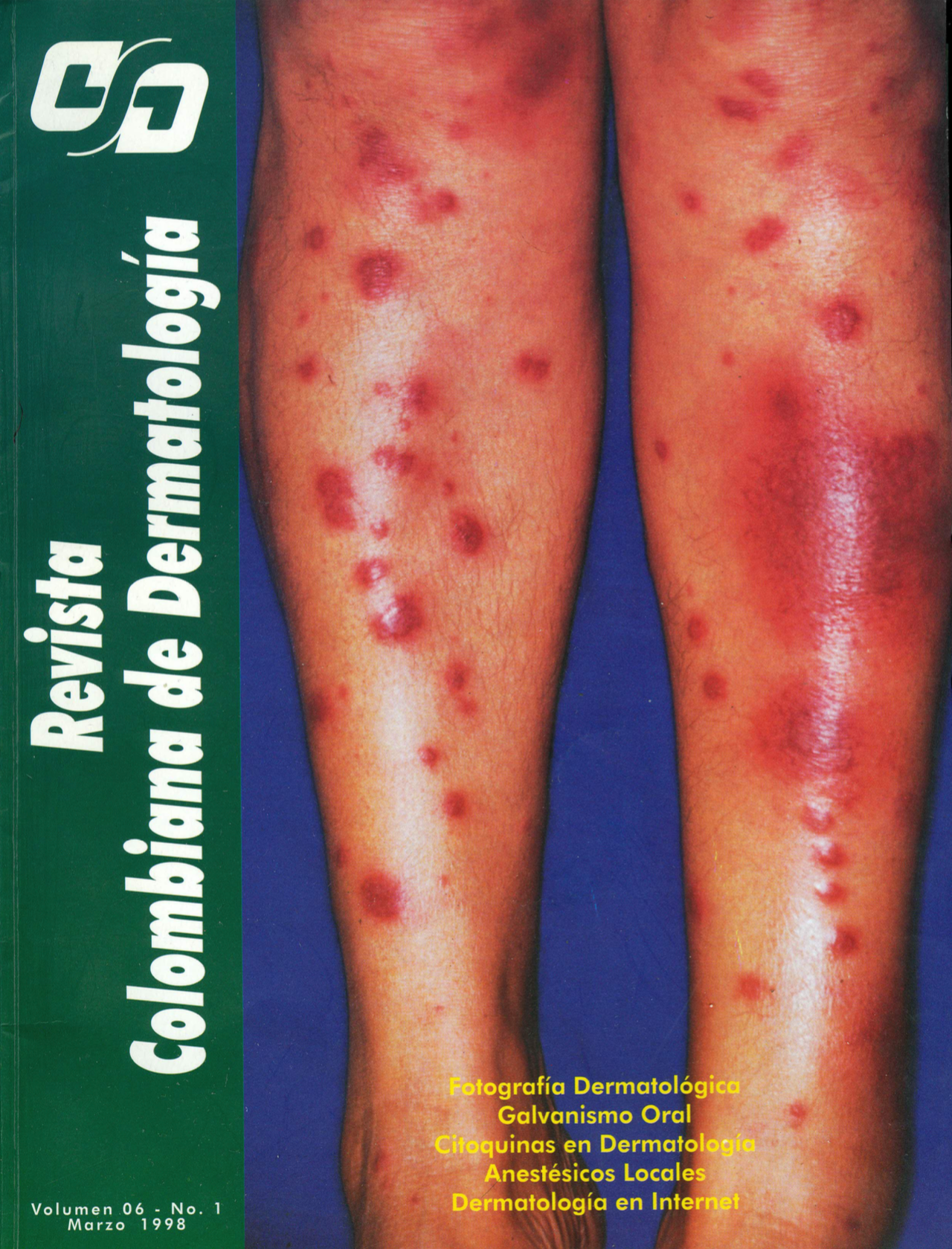 					Ver Vol. 6 Núm. 1 (1998): Marzo
				